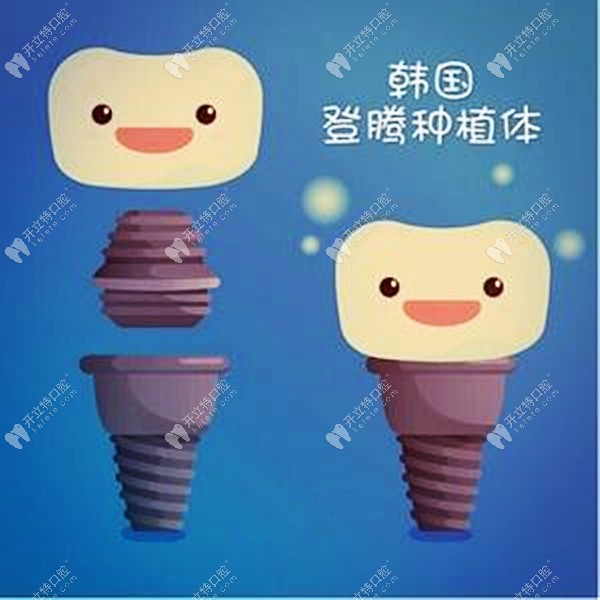 昆明做韓國(guó)純鈦登騰種植牙補(bǔ)貼價(jià)2399元一顆，也太便宜了吧