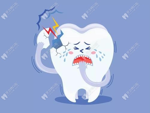 牙醫(yī)解答:牙根縱裂的形成原因和治療方法都在這了